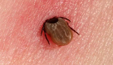 Tick and Lyme Disease